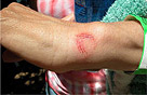 Fish bite